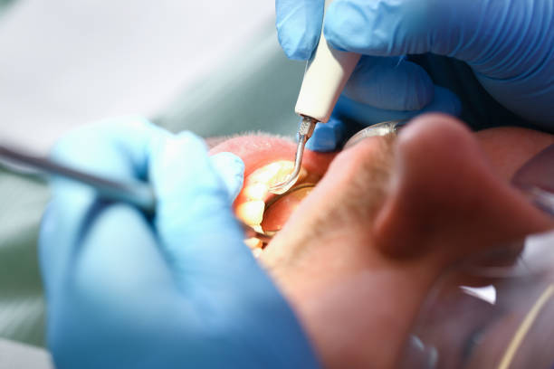 Best Dentist Open Late Near Me  in Benton, IL