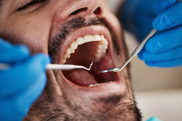 Best Tooth Infection Emergency Dentist  in Benton, IL